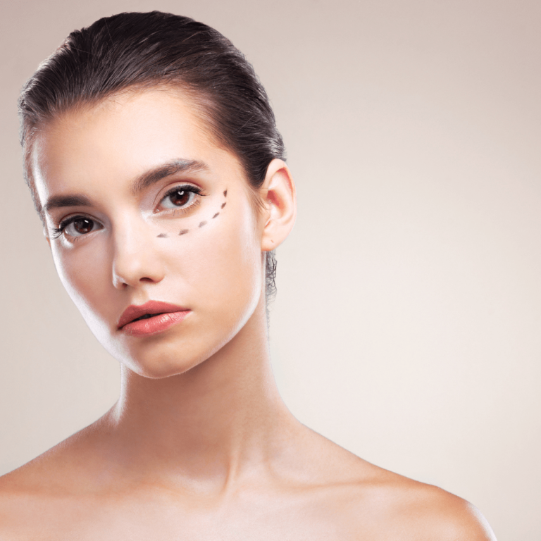 Göz Altı Morluk Tedavisi