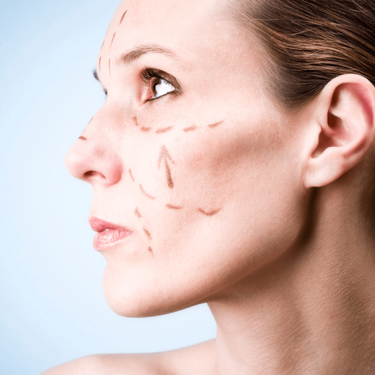 Radyo Frekans Sistemleri