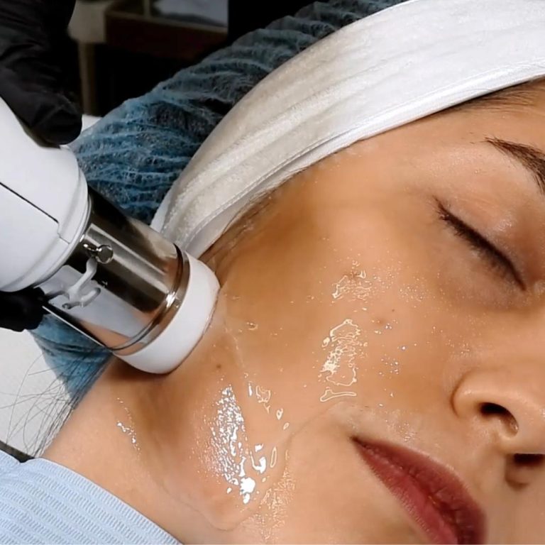 HIFU Yüksek Yoğunluklu Odaklanmış Ultrason ile Cilt Yenileme